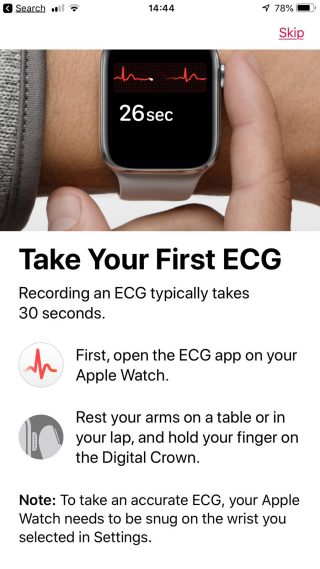 First ECG on Apple Watch